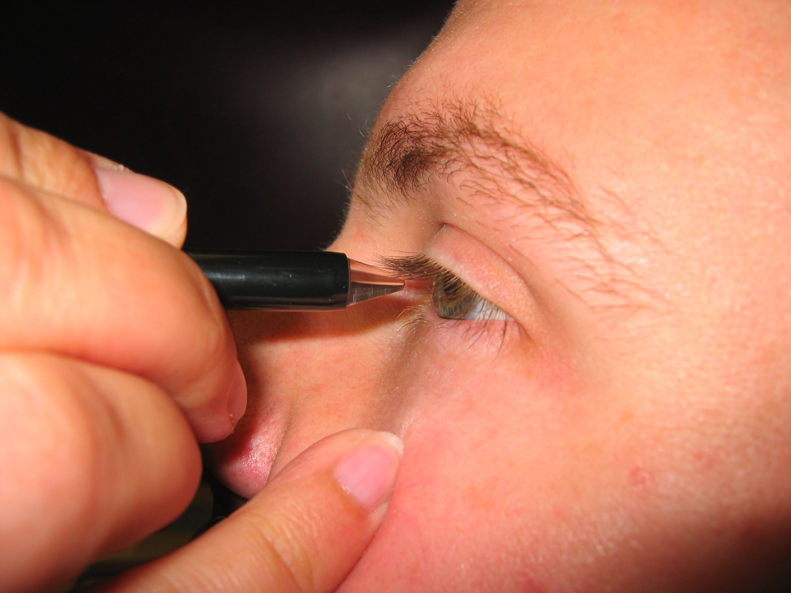 doctor performing a pachymetry